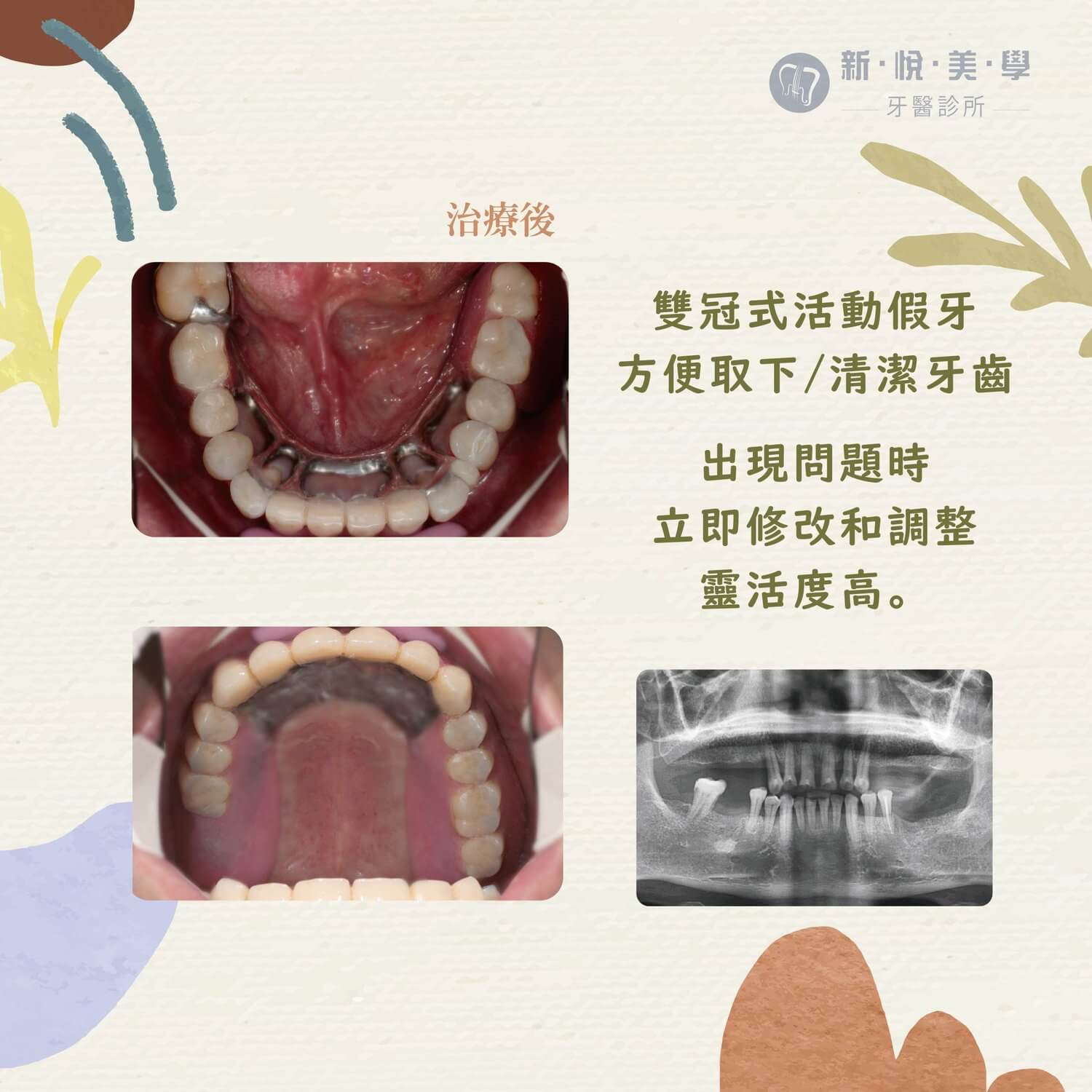 里長伯牙齒重生!工作不「滴累」的第2張圖片